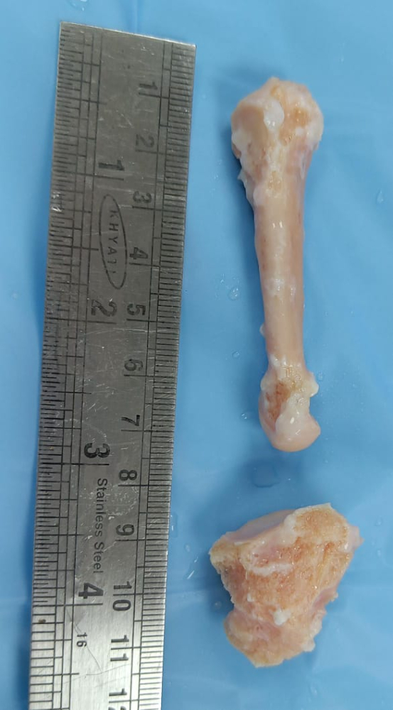 Metatarsal - MC127
