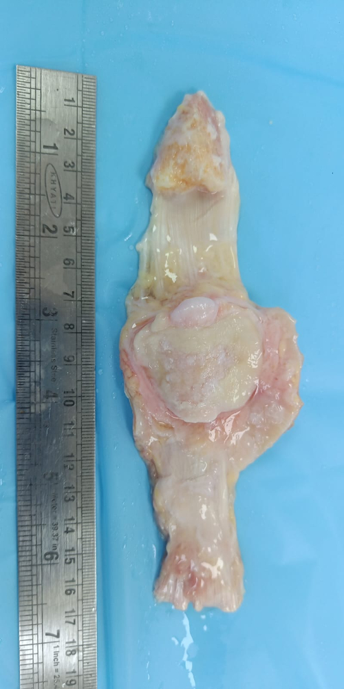 Quadriceps Tendon Unit - QT007