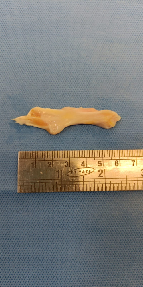 Tendon Small - TN(S)001