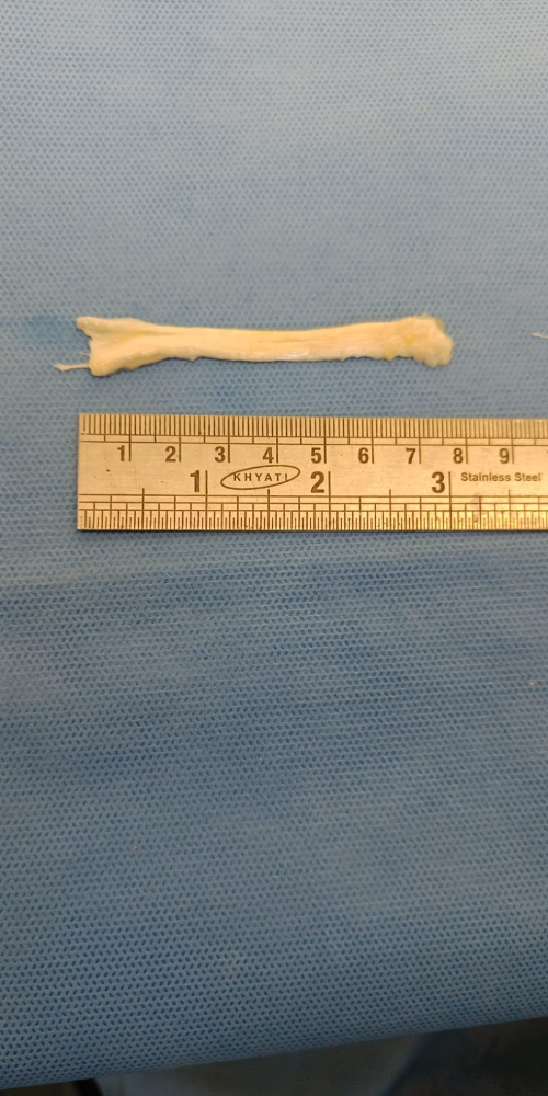 Tendon Small - TN(S)003