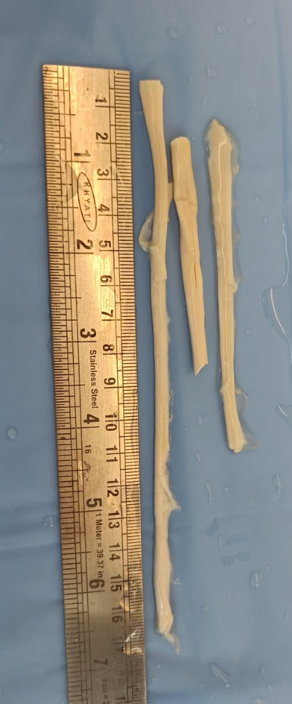 Tendon - TN255