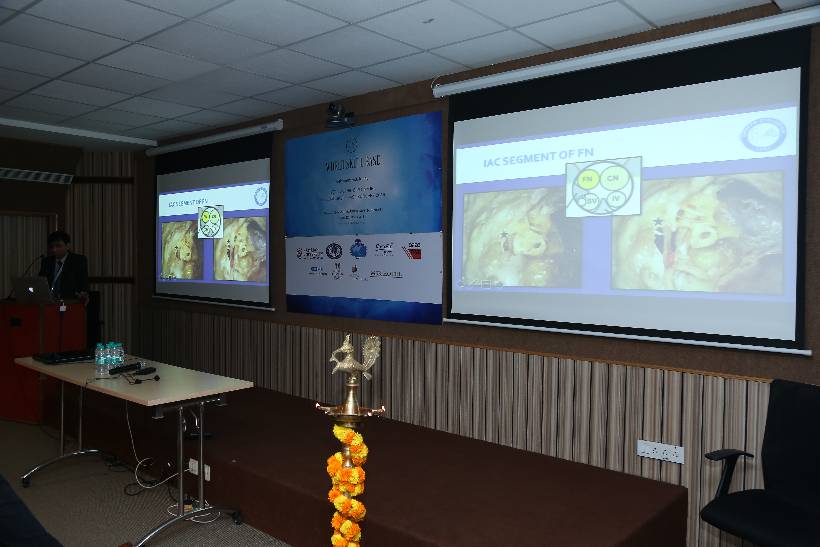 WSB Fellowship Diploma in Lateral Skull Base Surgery:  Module - I. 26th -30th March 2018.