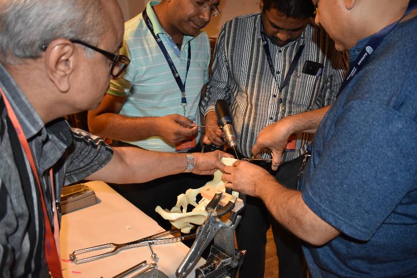 PELVI ACETABULAR TRAUMA WORKSHOP ADVANCED COURSE -  06th, 07th & 08th July 2018.