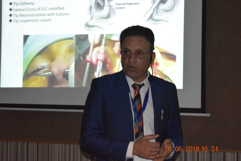Bangalore Facial Aesthetic Cadaver Dissection Course - 16th & 17th June 2018.